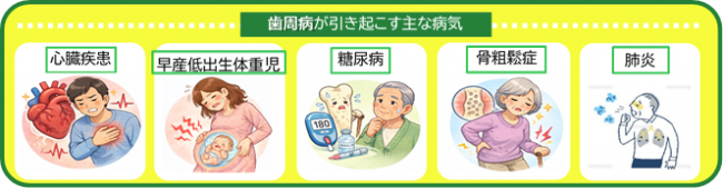 歯周病が引き起こす主な病気